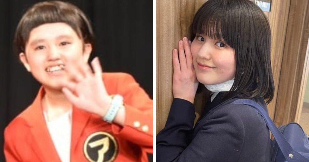 池田レイラ　可愛くなった　昔